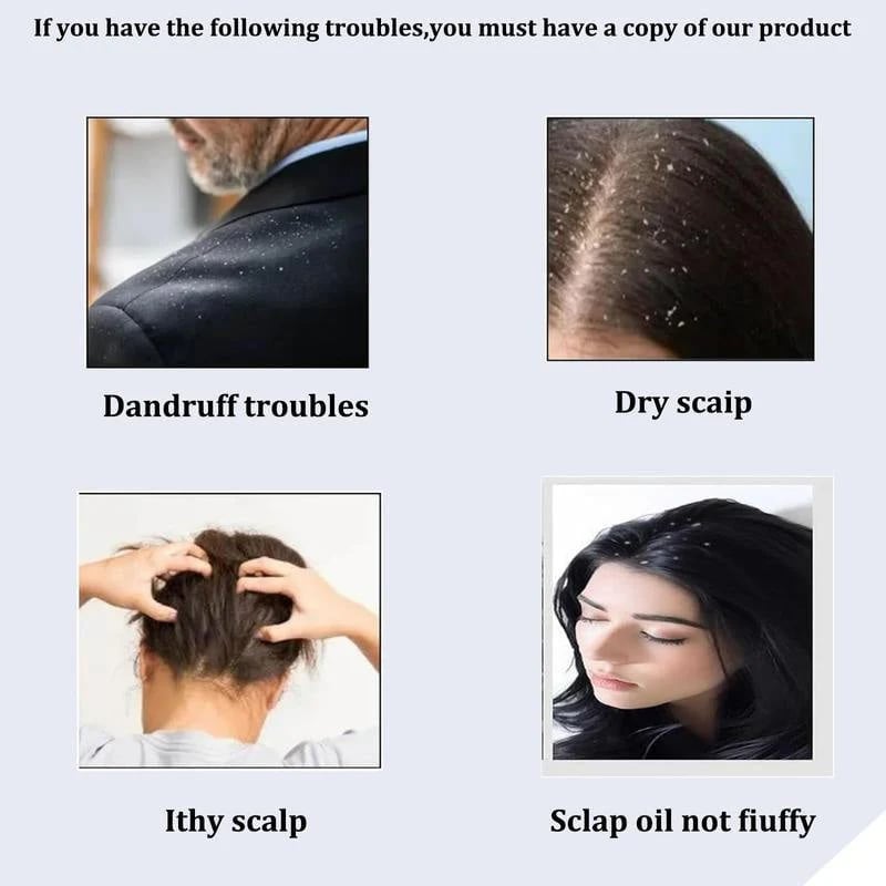 ❤The best gift for her👱♀️Anti-Dandruff Comb