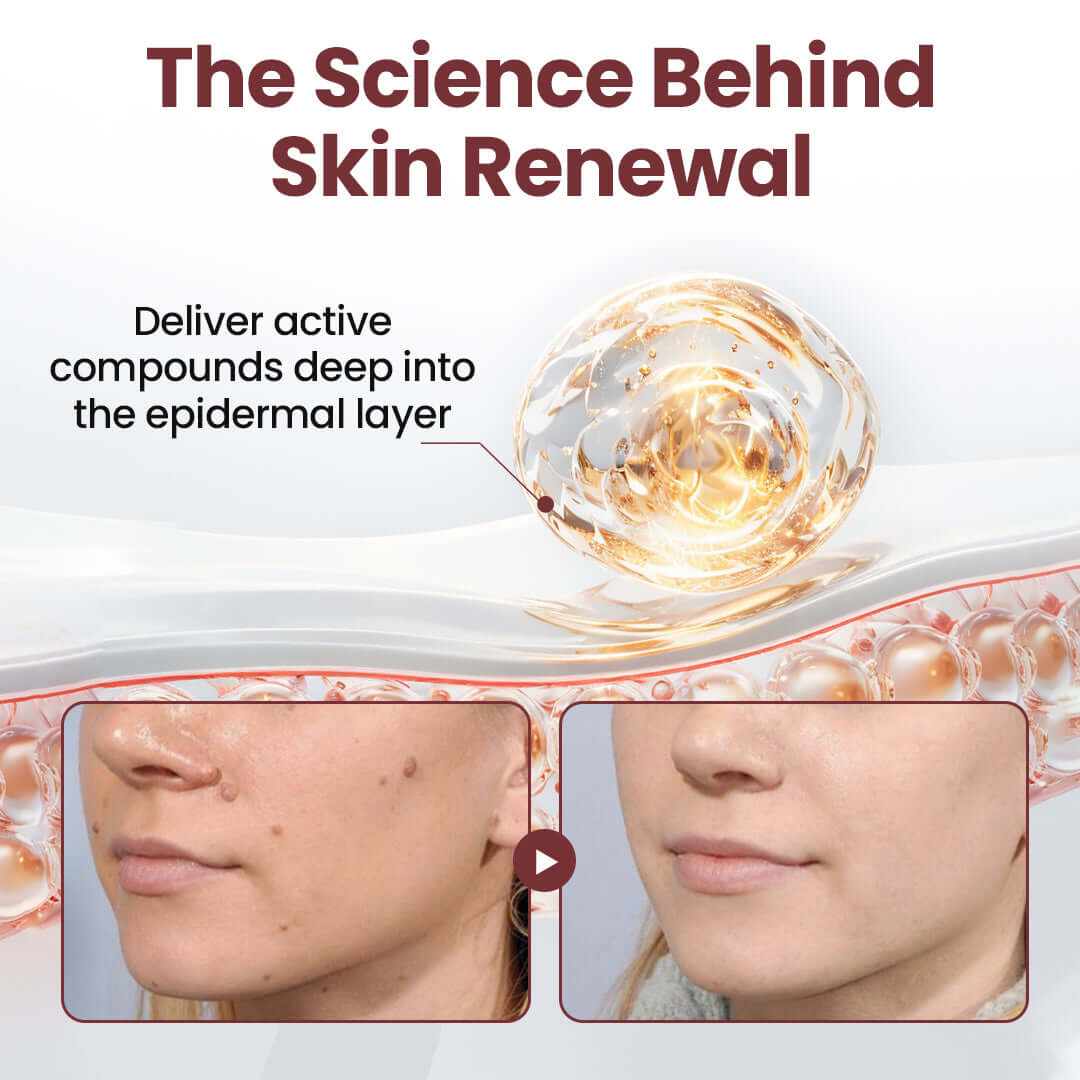 ✅Flash Sale - ODALIT®KeraErase Dual-Action Renewal Cream