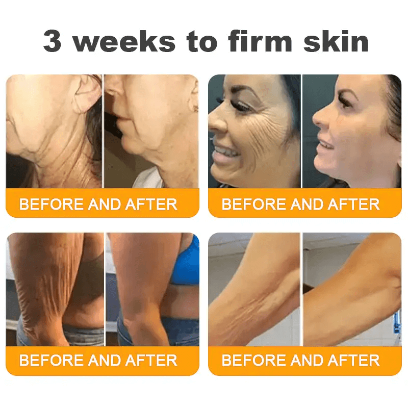 Natravor®𝐁𝐞𝐞 𝐕𝐞𝐧𝐨𝐦 𝐀𝐥𝐥-𝐢𝐧-𝐎𝐧𝐞 𝐂𝐫𝐞𝐚𝐦–🌸 Anti-aging,Hydrating, Skin Repair, Even Tone, Acne and Dark Spot Treatment, Wart and Mole Removal, Psoriasis Relief