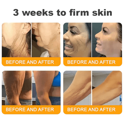 Natravor®𝐁𝐞𝐞 𝐕𝐞𝐧𝐨𝐦 𝐀𝐥𝐥-𝐢𝐧-𝐎𝐧𝐞 𝐂𝐫𝐞𝐚𝐦–🌸 Anti-aging,Hydrating, Skin Repair, Even Tone, Acne and Dark Spot Treatment, Wart and Mole Removal, Psoriasis Relief