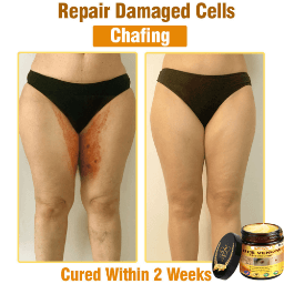 Natravor®𝐁𝐞𝐞 𝐕𝐞𝐧𝐨𝐦 𝐀𝐥𝐥-𝐢𝐧-𝐎𝐧𝐞 𝐂𝐫𝐞𝐚𝐦–🌸 Anti-aging,Hydrating, Skin Repair, Even Tone, Acne and Dark Spot Treatment, Wart and Mole Removal, Psoriasis Relief