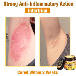 Natravor®𝐁𝐞𝐞 𝐕𝐞𝐧𝐨𝐦 𝐀𝐥𝐥-𝐢𝐧-𝐎𝐧𝐞 𝐂𝐫𝐞𝐚𝐦–🌸 Anti-aging,Hydrating, Skin Repair, Even Tone, Acne and Dark Spot Treatment, Wart and Mole Removal, Psoriasis Relief