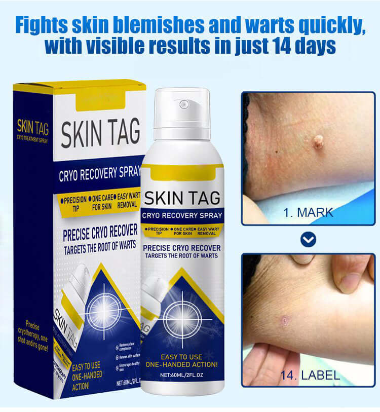 Wart Care Topical Spray