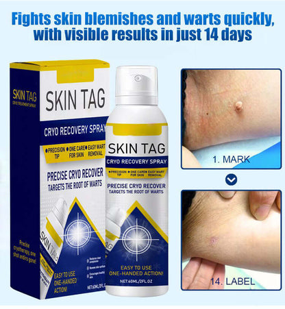 Wart Care Topical Spray