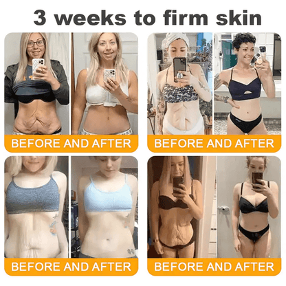 Natravor®𝐁𝐞𝐞 𝐕𝐞𝐧𝐨𝐦 𝐀𝐥𝐥-𝐢𝐧-𝐎𝐧𝐞 𝐂𝐫𝐞𝐚𝐦–🌸 Anti-aging,Hydrating, Skin Repair, Even Tone, Acne and Dark Spot Treatment, Wart and Mole Removal, Psoriasis Relief