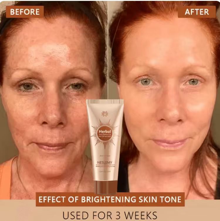 Whitening and Spot-Removing Face Mask Suitable for face and body – 👩‍⚕️ Natural ingredients permanently remove age spots, freckles, sun spots, and liver spots.