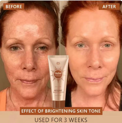 Whitening and Spot-Removing Face Mask Suitable for face and body – 👩‍⚕️ Natural ingredients permanently remove age spots, freckles, sun spots, and liver spots.
