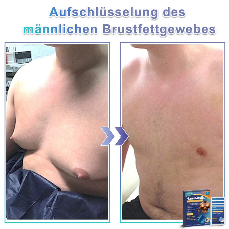🔥STARTYNX®NanoMedix™ Gynecomastia Breast Fat Burning & Firming Patch