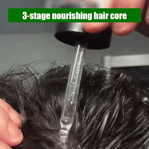 [Hair volume increases rapidly] Promote hair growth and strengthen hair care essential oil✨