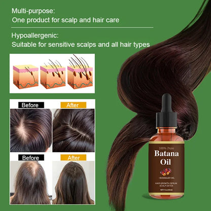 [Hair volume increases rapidly] Promote hair growth and strengthen hair care essential oil✨