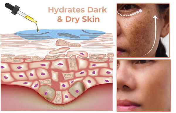 ✨Fast Dark Spot Remover-Natravor®  Melanin Correcting Facial Serum(🔥Last Day Promotion 60% OFF)