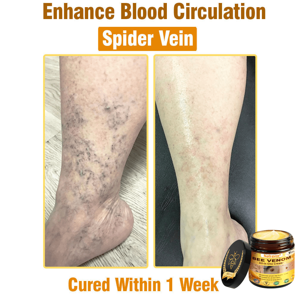 Natravor®𝐁𝐞𝐞 𝐕𝐞𝐧𝐨𝐦 𝐀𝐥𝐥-𝐢𝐧-𝐎𝐧𝐞 𝐂𝐫𝐞𝐚𝐦–🌸 Anti-aging,Hydrating, Skin Repair, Even Tone, Acne and Dark Spot Treatment, Wart and Mole Removal, Psoriasis Relief