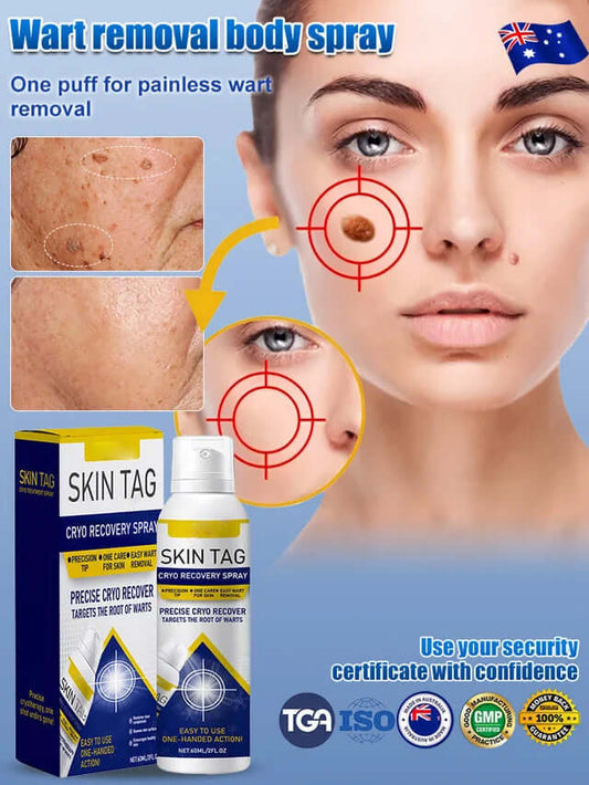 Wart Care Topical Spray