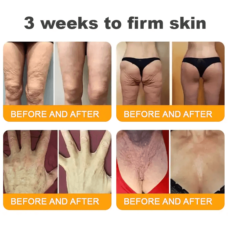 Natravor®𝐁𝐞𝐞 𝐕𝐞𝐧𝐨𝐦 𝐀𝐥𝐥-𝐢𝐧-𝐎𝐧𝐞 𝐂𝐫𝐞𝐚𝐦–🌸 Anti-aging,Hydrating, Skin Repair, Even Tone, Acne and Dark Spot Treatment, Wart and Mole Removal, Psoriasis Relief