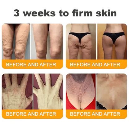 Natravor®𝐁𝐞𝐞 𝐕𝐞𝐧𝐨𝐦 𝐀𝐥𝐥-𝐢𝐧-𝐎𝐧𝐞 𝐂𝐫𝐞𝐚𝐦–🌸 Anti-aging,Hydrating, Skin Repair, Even Tone, Acne and Dark Spot Treatment, Wart and Mole Removal, Psoriasis Relief