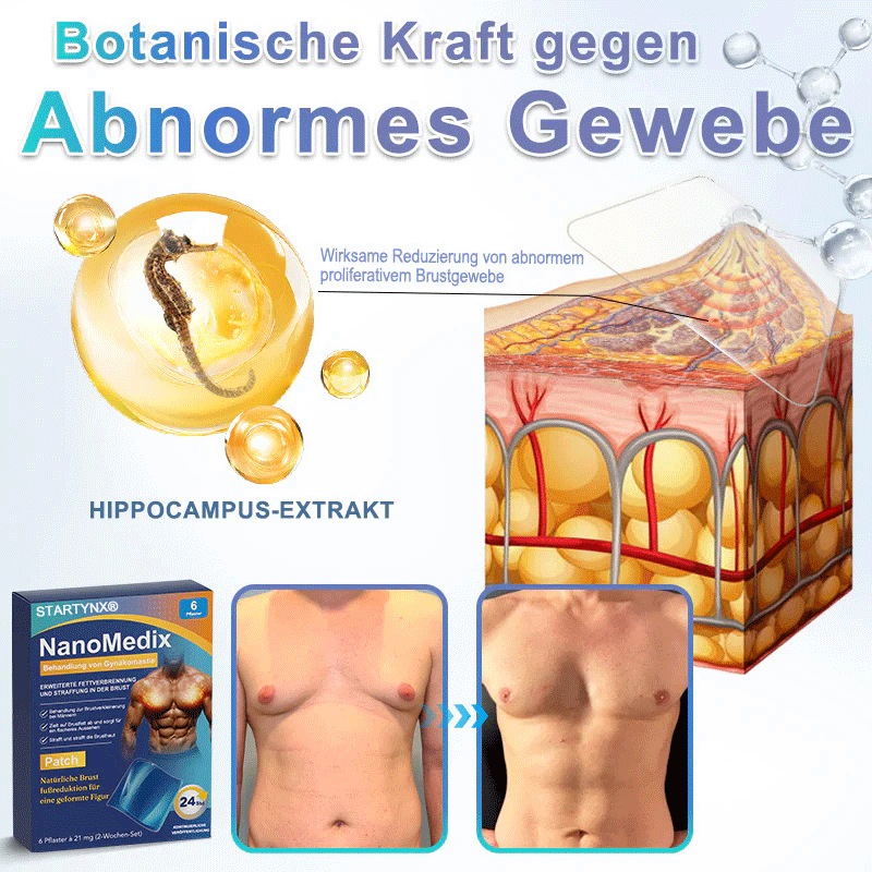 🔥STARTYNX®NanoMedix™ Gynecomastia Breast Fat Burning & Firming Patch